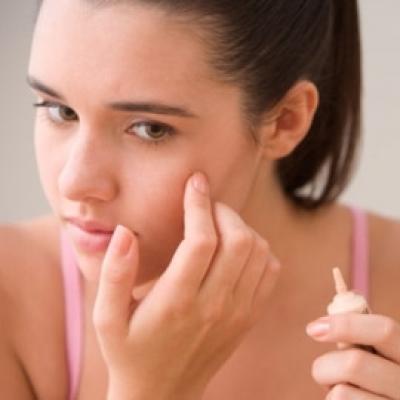 tips for acne free complexion