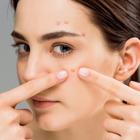Best Drugstore Serums For Acne Prone Skin